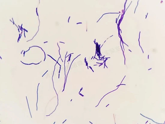 Lactobacillus crispatus Picture below Lactobacillus crispatus Picture below